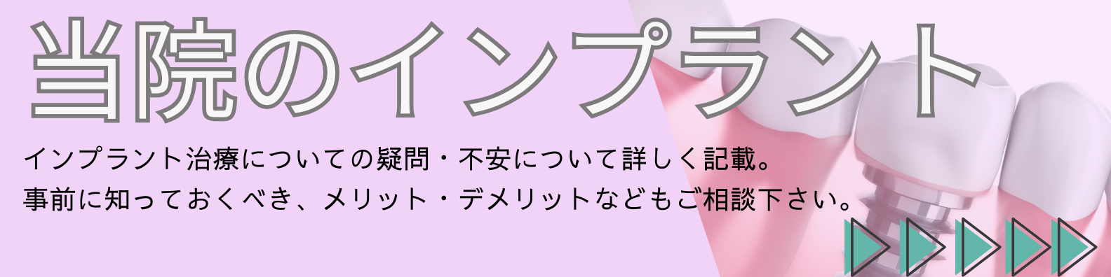 インプラントページ